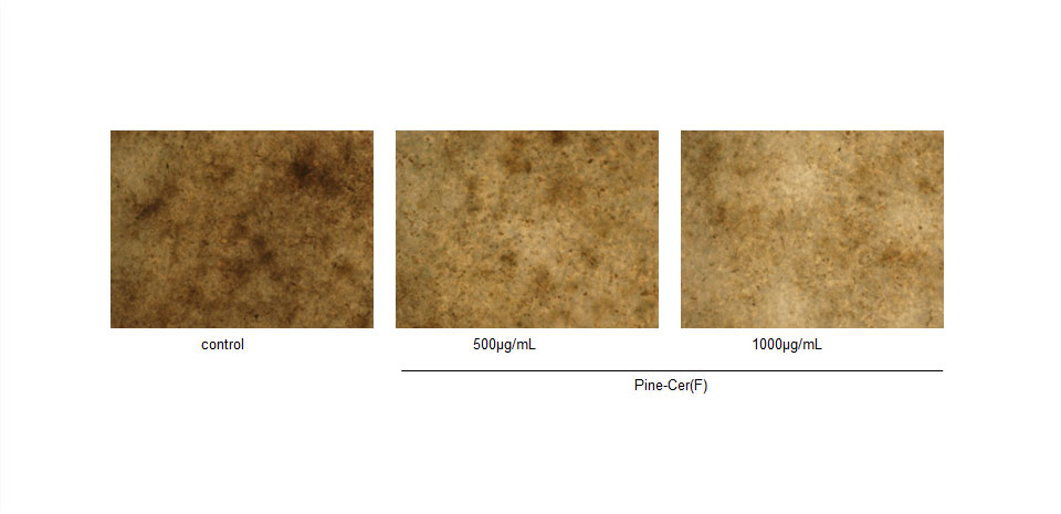 図3　ヒト3次元皮膚モデルでのメラニン産生抑制作用（培養終了後の顕微鏡写真）