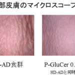 乾燥肌モデルマウスを用いた皮膚機能改善効果の検討（1）